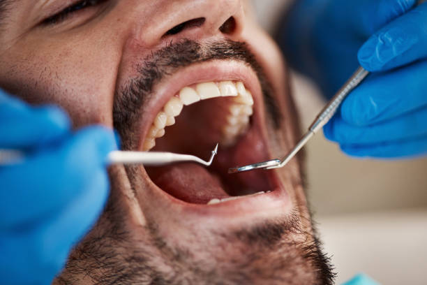 Best Cosmetic Dentistry  in Ellisville, MS